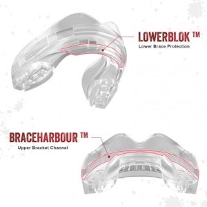 Ochraniacz na Zęby SafeJawz do Aparatu Ortodontycznego